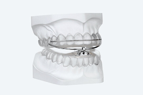 Dental sleep medicine